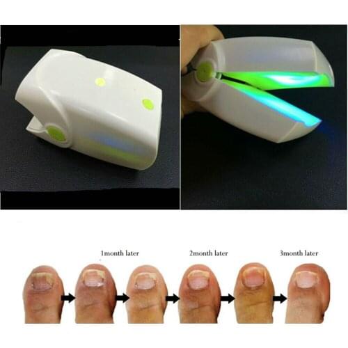 Nail Cleaning Laser Device Nail Fungus Treatment Cold Laser Therapy Physical Therapy