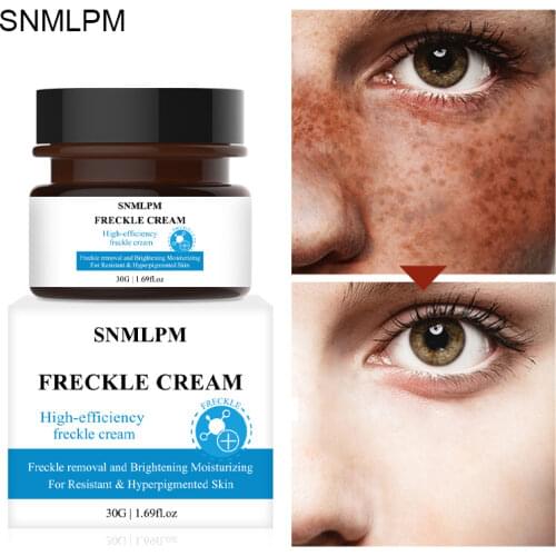 Effective Whitening Freckle Cream Remove Melasma Acne Spot Pigment Melanin Dark Spots Pigmentation Moisturizing Cream Skin Care