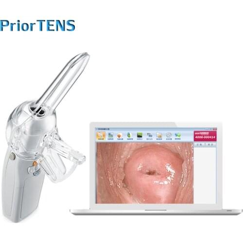 Mini Colposcope Vaginal Endoscope Colposcopy Portable Digital Video Electronic Self-exam Speculum Mirror for Hospital Clinic USB