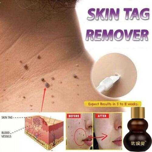 Инструменты для чистки лица WWW.AQISI.COM China At AliExpress