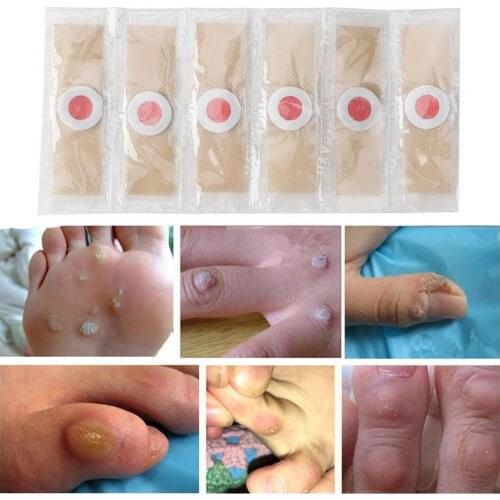 Foot Corn Killer Calluses Plantar Warts Thorn Pain Medical Relief Care Foot Toe Plaster Tool Sticker Protector Y2M8