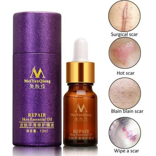 Scar Repair Skin Essential Oil Lavender Essence Skin Care Remove Ance Burn 10ml