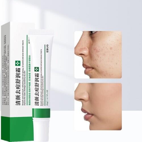 Effective Acne Removal Cream Acne Treatment Fade Acne Spots Oil Control Shrink Pores Whitening Moisturizing Acne Cream Skin Care
