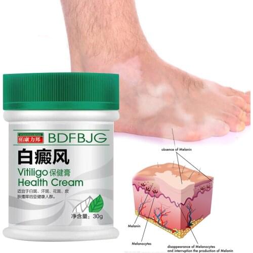 Vitiligo Ointment Treament White Spot Psoriasis Cream Piebald Sweat Spots Skin Care Herbal Medical Plaster