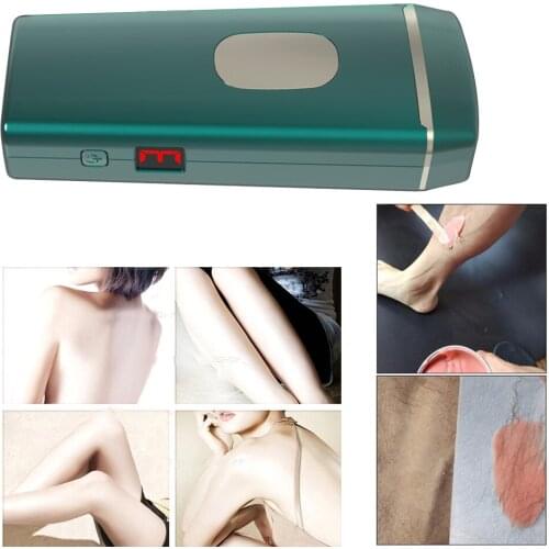 Body Face Neck Leg Hair Removal Tool LCD IPL Laser Epilator 990000 Flashes Hair Removal Device for Bikini Face Body