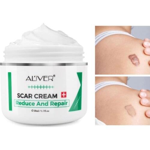 97g Scar Repair Cream Remove Stretch Mark Scald Caesarean Bump Surgery Scar Repairs The Skin TSLM2