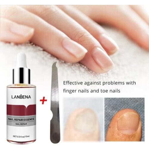LANBENA Nail Repair Serum Anti Fungal Nail Treatments Remove Onychomycosis Nourishing Brighten Hand Foot Toes Nail Care TSLM1