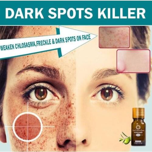 Ultra Brightening Spotless Oil Skin Care Dark Spots Remove Ance Burn Strentch Marks Scar Removal Brightening Skin Essence 10ml