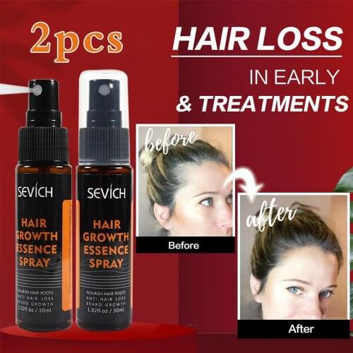 Anti Hair Loss Products Hair Growth Spray Essential Oil Liquid for Men Women Hair Growth Essence Serum Hair Care Repair Growing