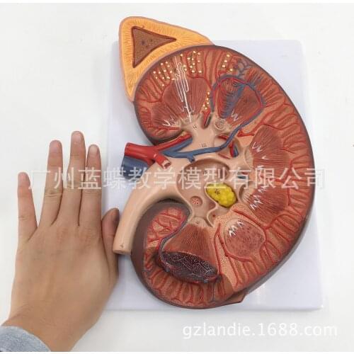 3 Times Amplification Human Kidney Anatomy Model Adrenal Gland