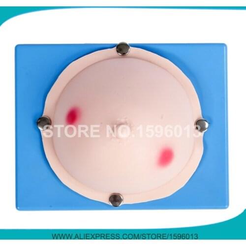 Vivid Mammary Abscess Examination Model,Breast Examination Model,Breast Abscess Simulator