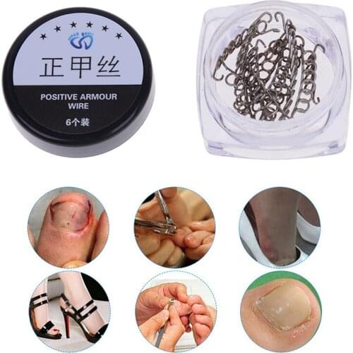 12Pcs Ingrown Toe Nail Correction Wire Fixer Pedicure Paronychia Recover Toenails Corrector Foot Care Tool