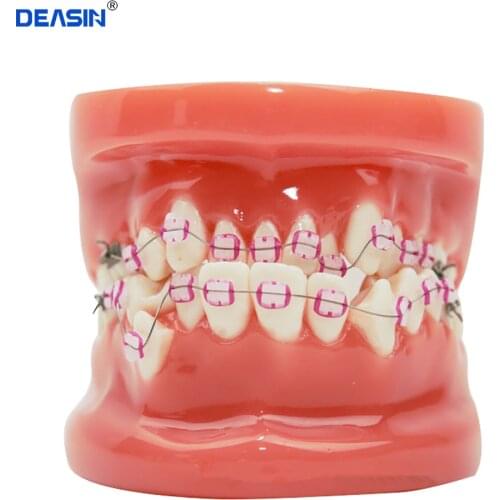 Dental Oral Care Teeth Model Dentist Orthodontic Tooth Model Demonstration Teaching