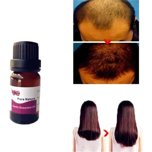 10ml Garlic Dry And Maintenance Hair Nutrition Essential Oil Treatment Essence Fast Hair Growth Liquid Hair Loss Products