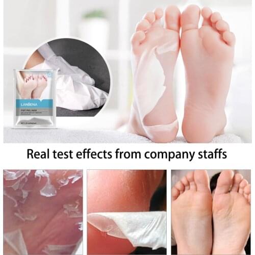 Skin Friendly Foot Mask Peeling Tender Legs Feet Mask Scrub Exfoliating Socks Anti Crack Heel Remove Skin Foot Care Patch