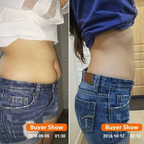 KONGDY Slimming Patches