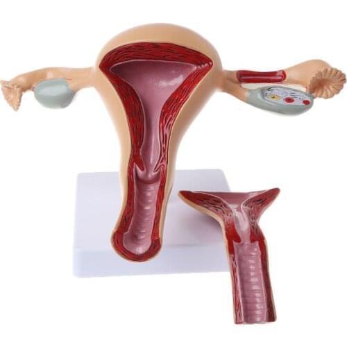 Human Pathological Uterus Ovary Model Anatomical Anatomy Disease Pathology Medical Lesion Teaching tools