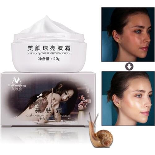 40g Powerful Whitening Freckle Cream Remove Melasma Acne Spots Pigment Melanin Moisturizing Strong Effects Skin Whitening Cream