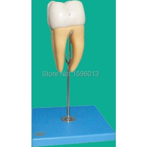 Molar Model, molar anatomical model 14 positions displayed, teeth model