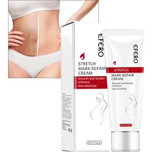 Efero Scars Pregnancy Repair Cream Scars Stretchers Remove Maternity Treatment Skin Repair Anti Wrinkle Firming Body Creams 40g