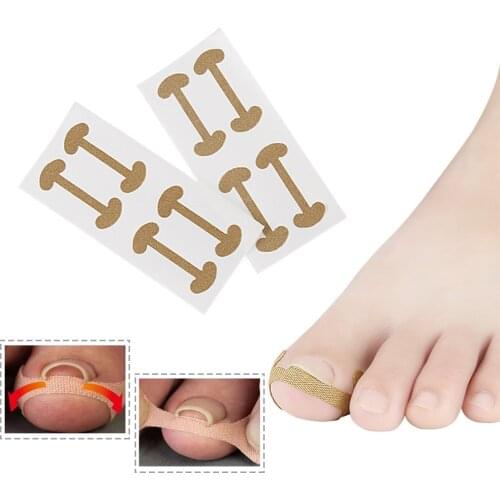20pcs Professional Nail Care Embedded Toe Nail Corrector Sticker Toenail Care Pedicure Thumb Curl Correction Sticker Foot Care