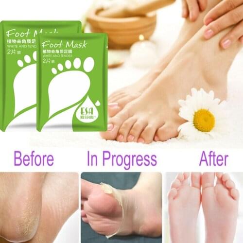 2pcs / package foot exfoliation and calluses heel mask softening keratin foot care