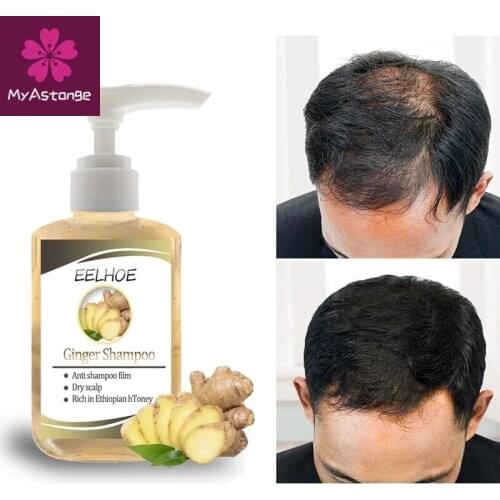 Ginseng Anti-Hair Loss Shampoo Powerful Treatment Essence Herbs Ginger Cooler Hair Growth Lotions For Men Women