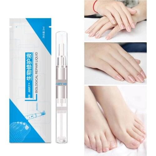 Nail Health Device Anti Fungus Anti Fungus Nail Pen Liquid Onychomycosis Paronychia Infection Herbal Toe Finger Treatment Liquid