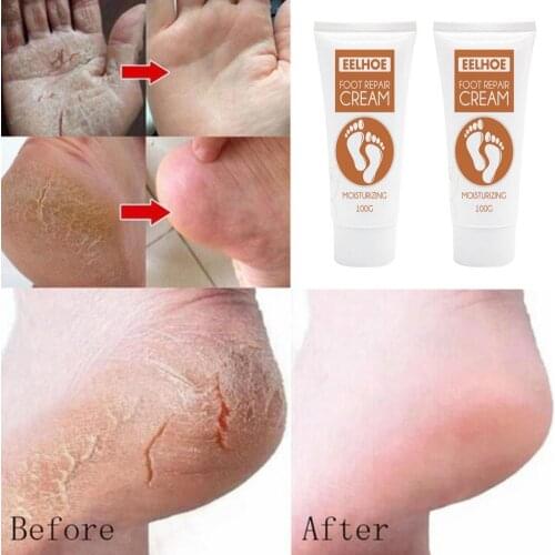 100g EELHOE Foot Care Cream Long Lasting Effect Deep Penetration Cream Cracked Heel Treatment Cream for Health Foot Care Cream