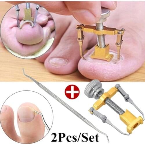 Ingrown toenails correction pedicure foot toe nail care tools file Elastic Patch Straightening Clip Brace corrector Wire Fixer