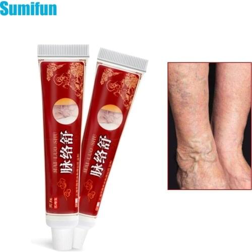 20G 1Pcs Varicose Veins Treatment Cream Vasculitis Phlebitis Spider Veins Leg Varicosity Angiitis Ointment Health Care P1162