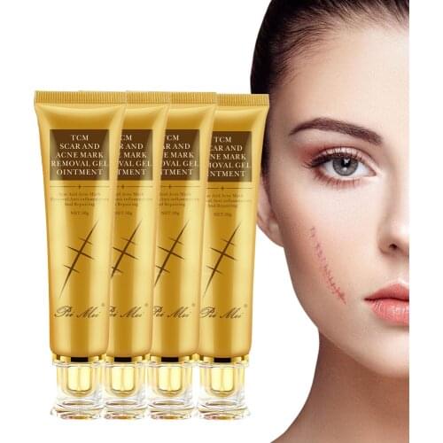 4Pcs Acne Scar Removal Cream Pimples Stretch Marks Face Gel Remove Acne Smoothing Whitening Moisturizing Body Skin Care Gel