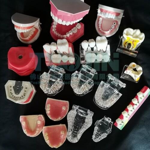Various Dental Teeth Models Dentist False Tooth Model Dentistry Training Study learning Tools