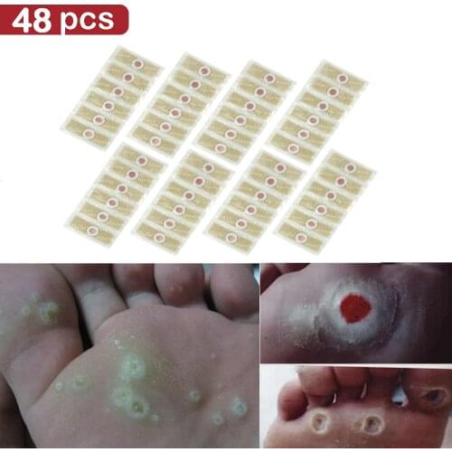 48pcs Foot Plaster Corn Removal Remover Warts Thorn Plaster Health Care For Relieving Pain Calluses Plaster Medical Plaster