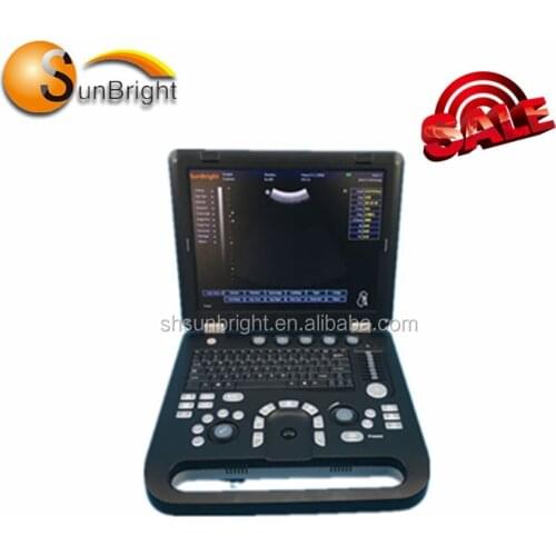 Color ultrasonic scan portable medical ultrasound test machine for hospital