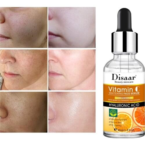 Disaar Vitamin C Whitening Face Serum Fading Acne Marks Moisturizing Shrink Pores Brightening Skin Face Essence 30ml