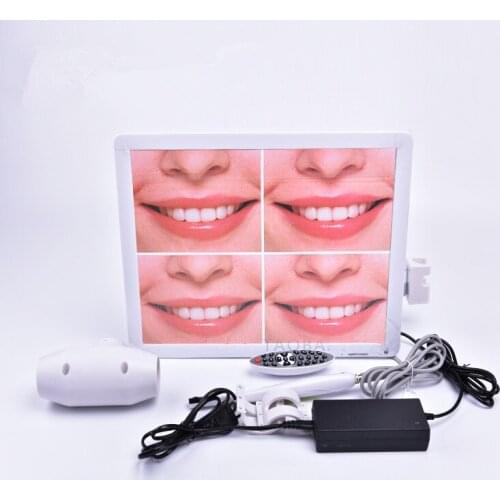 Good Quality Dental endoscope machine oral endoscopic camera with high-definition 17-inch monitor