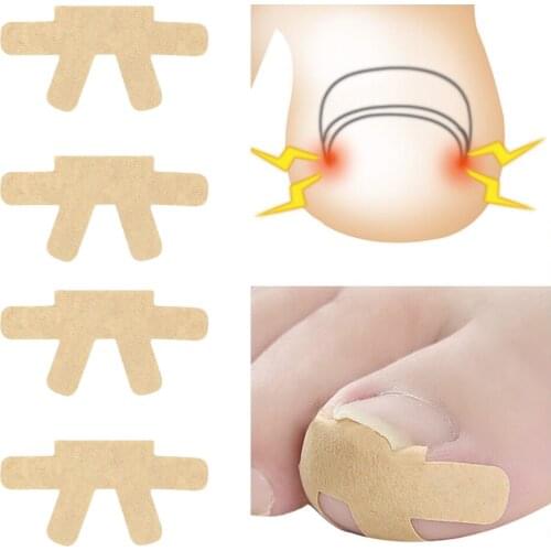 4 Pieces Elastic Ingrown Toenail Corrector Stickers Strips Pedicure Tools Toenail Patch Tape Protector for Men Women