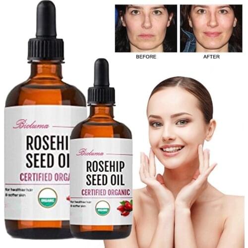 Pure Essential Oils Rosehip Oil Moisturizing Brighten Skin Color Essential Oil Anti-Dry Anti-Aging Face Essential 10ml/30ml