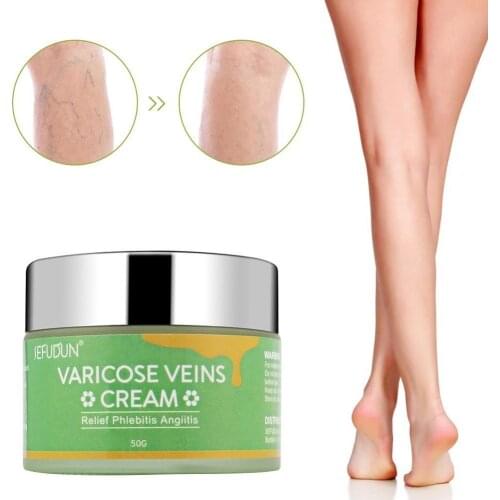1Pcs 50g Varicose Veins Ointment Vasculitis Phlebitis Cream Varicosity Angiitis Removal Medical Plaster Spider Herbal B6X1