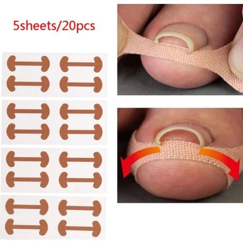 20pcs Professional Ingrown Toenail Foot Corrector Stickers Elasticity Toe Nail Care Pedicure Tools Health Care Protects Toe Nail