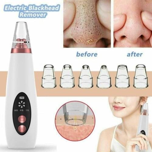 USB Rechargeable Blackhead Remover Face Pore Vacuum Skin Care Acne Pore Cleaner Pimple Removal Vacuum Suction Tools