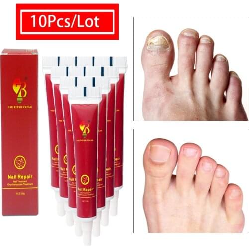 10Pcs Dropshipping High Quality Nail Foot Protector Skin Care Cream Nail Fungus Treatment Herb Nails Repair Cream Nail Care Tool