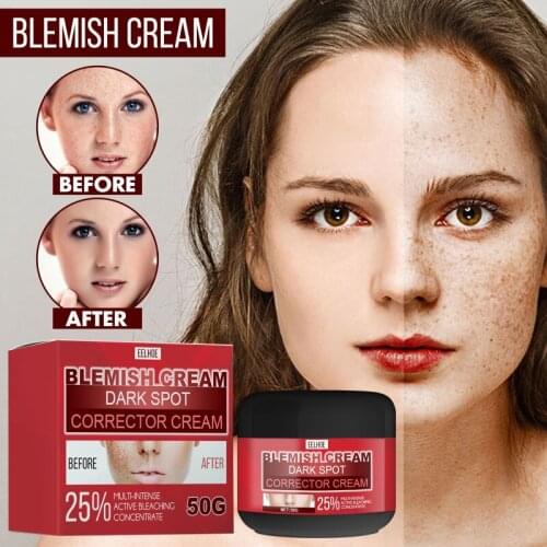Whitening Freckle Cream Remove Melasma Acne Spot Pigment Melanin Dark Spots Pigmentation Moisturizing Gel Skin Care TSLM1