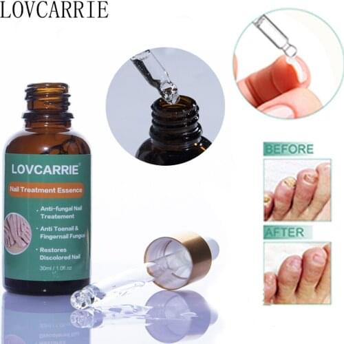 LOVCARRIE 30ML Nail Fungus Treatment Cuticle Oil Essence Herbal Oil for Nails Care Feet Toenail Repair Paronychia Onychomycosis