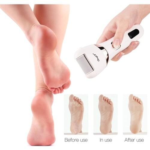 CkeyiN Electric Callus Remover USB Rechargeable Feet Grinding Roller Foot File Heel Dead Skin Peeling Pedicure Tool 3 Rollers