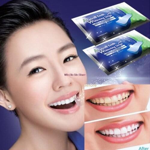 4 Stuks/2 Paar Professionele Mondhygiëneprotocol Tanden Witter Gereedschap Tanden Whitening Strips Gel Bleken Whitening bleach