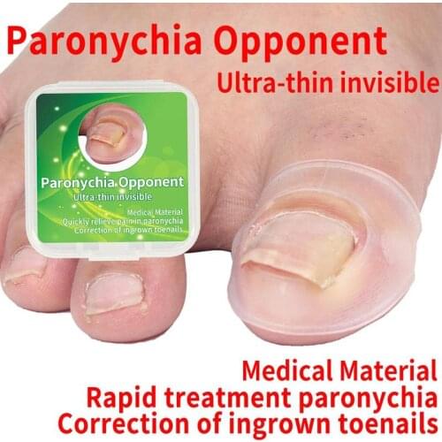 Ingrown Armor Elastic Patch Sticker Straightening Clip Brace Toenail Correction Tool Ingrown Toe Nail Treatment Pedicure Tool