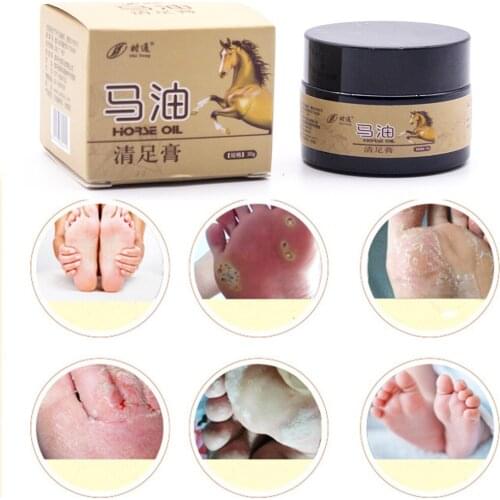 30g Foot Cream of Horse Oil Foot Odor Itchy Feet-erosion Blisters Peeling Athletes foot Helath Care Natural Ointment Family Use