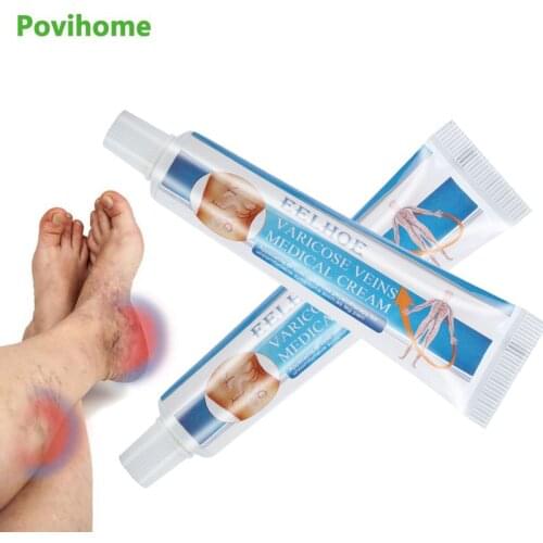1pcs Varicose Veins Treatment Cream Vasculitis Phlebitis Spider Ointment Varicosity Angiitis Removal Herbal Medical Plaster